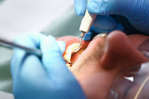 Best Urgent Dental Care for Toothache in Deep River Center, CT